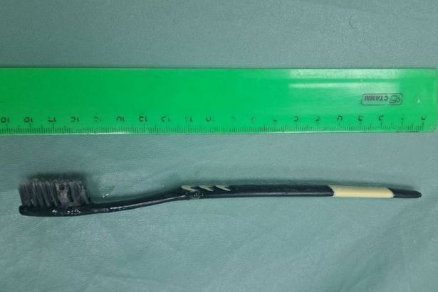 Необычный случай в Зеленограде: врачи извлекли зубную щётку из желудка пациентки