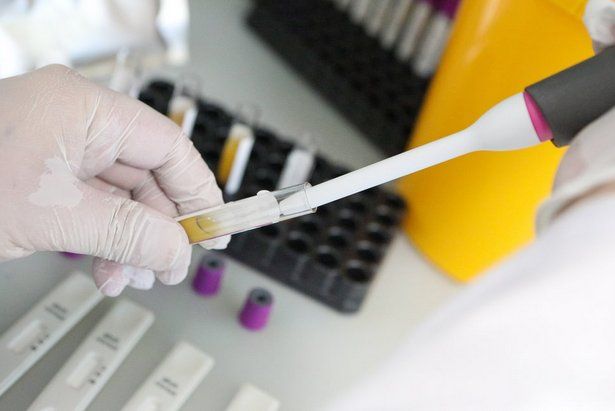 В Москве в сутки проводят 25 тысяч тестов на коронавирус