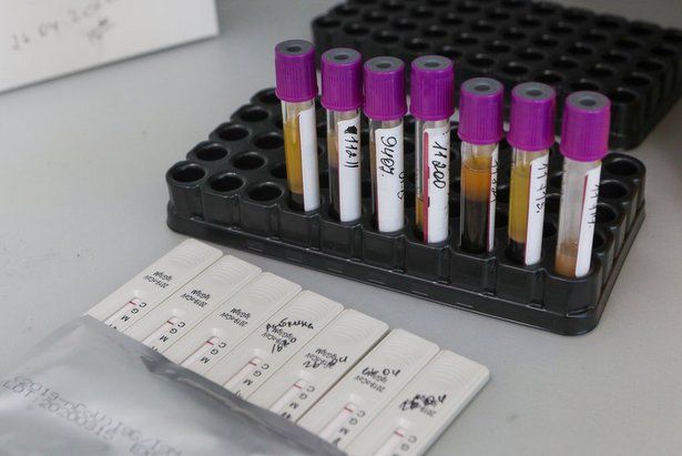 В медучреждения Москвы поставили 100 тыс экспресс-тестов на иммунитет к COVID-19